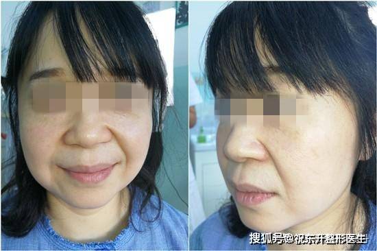 b44819ee85cb46b8a5810139ef92ac48.jpeg