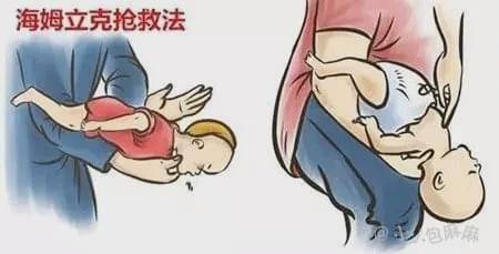 原创收藏！孩子12种高发意外伤，这些“救命图”一定要存好！