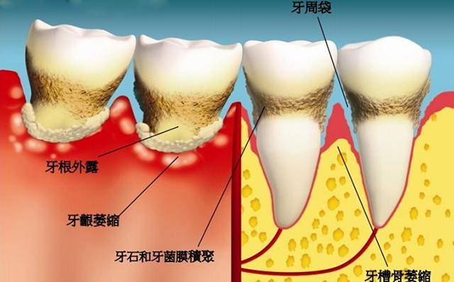 孕妇|大多人都不当回事，不仅自己受罪还连累胎儿孕期最怕“遇到”它