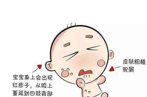严重|要让宝宝告别湿疹, 从这几点做起!