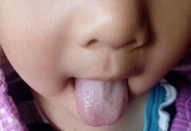 孩子|不是山楂条，每天吃一点，健脾胃，长高高！积食最怕一种“小饼干”