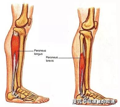 危害四:骰骨移位或第五趾骨骨折.
