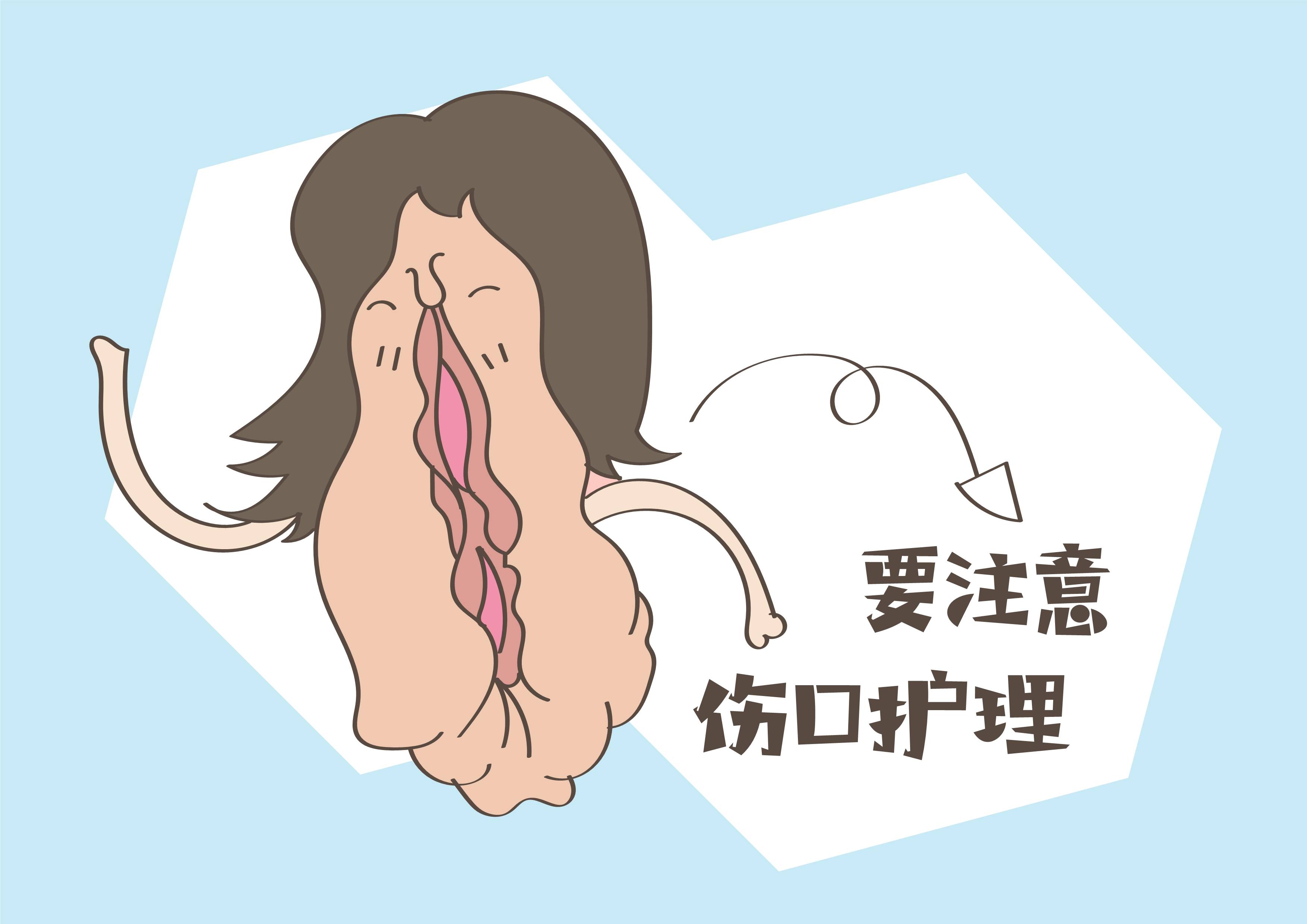 原创顺产该不该侧切，可不是你说了算，这两类宝妈医生表示别执着！