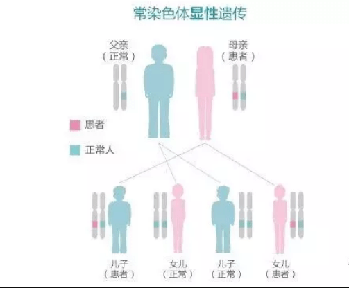 结节性硬化的认知