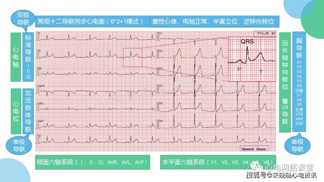 六轴系统在心电图学习中的运用