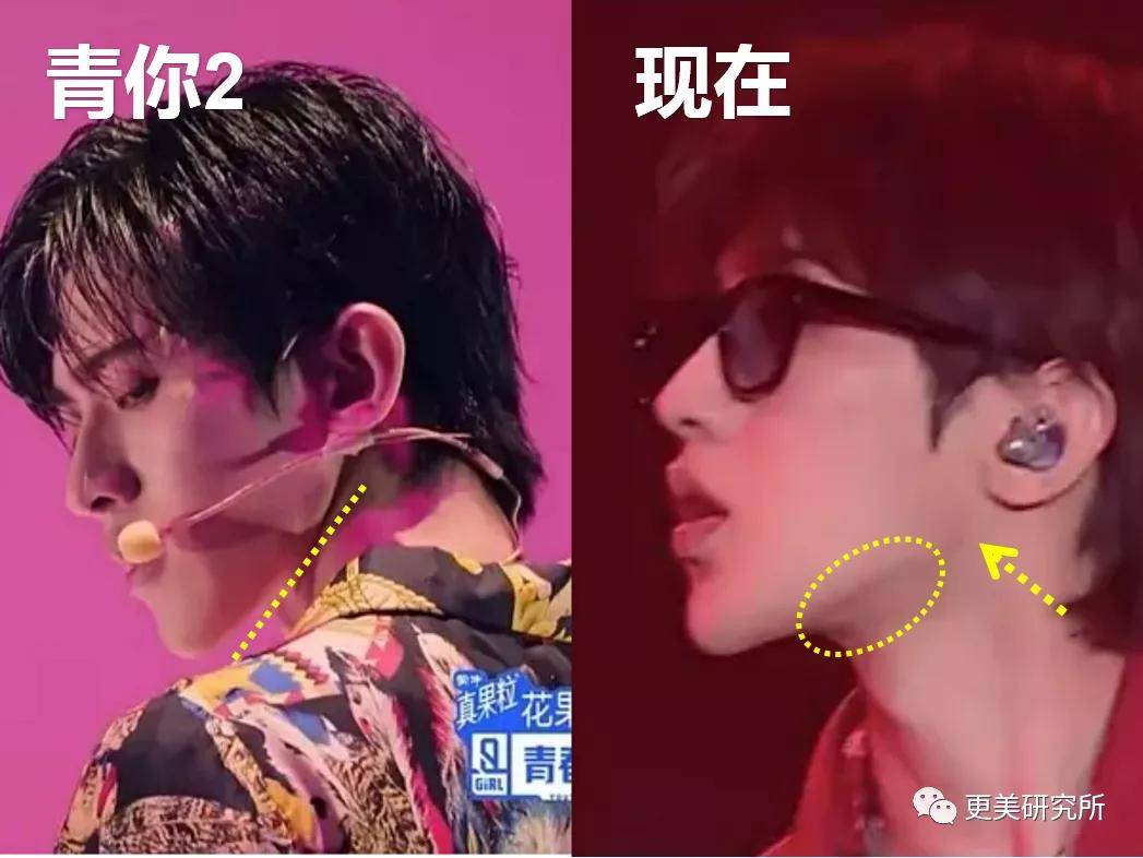 伸缩|蔡徐坤的下巴会自动伸缩？！这是do脸实锤了？