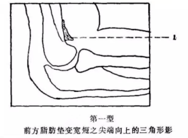126fff3c0d0344468b48707267954be4.png