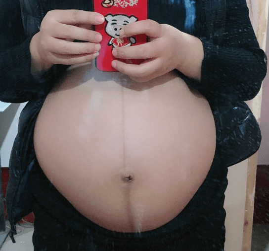 孕晚期胎动少正常 30d0a842707648528fb4fc46f0bcec45.png