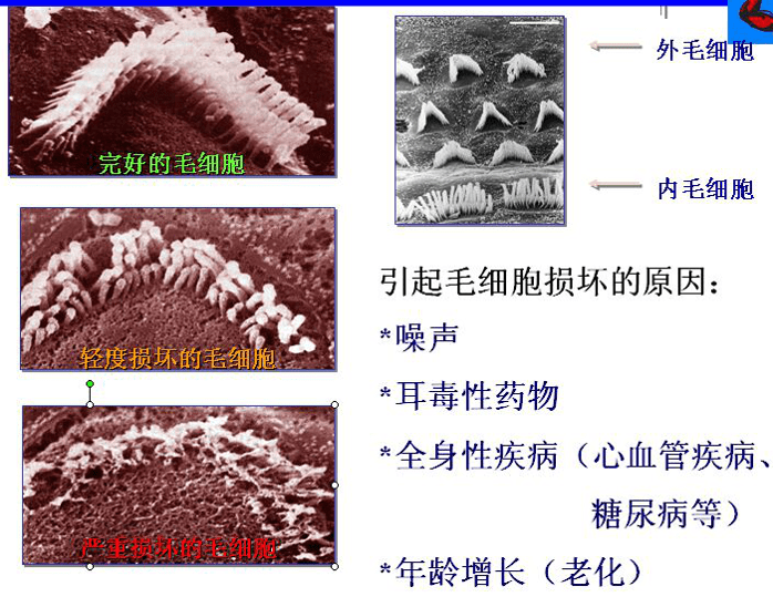 电镜下健康耳蜗毛细胞的状态毛细胞顶部纤毛的弯曲或偏转是对声波振动