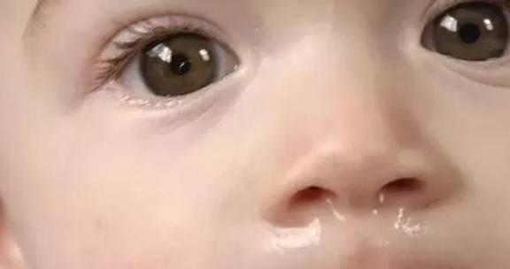 鼻涕|宝宝流鼻涕可不一定就是感冒! 四种不让宝宝流鼻涕的方法等你学~
