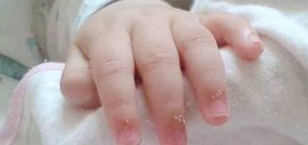 孩子|宝宝的指甲会“说话”, 遇到这4种状况不能忽视, 宝妈来看看!