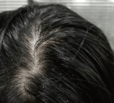 怎么护理头发强韧 41d8837527d0451b8f5d682180f9721a.png