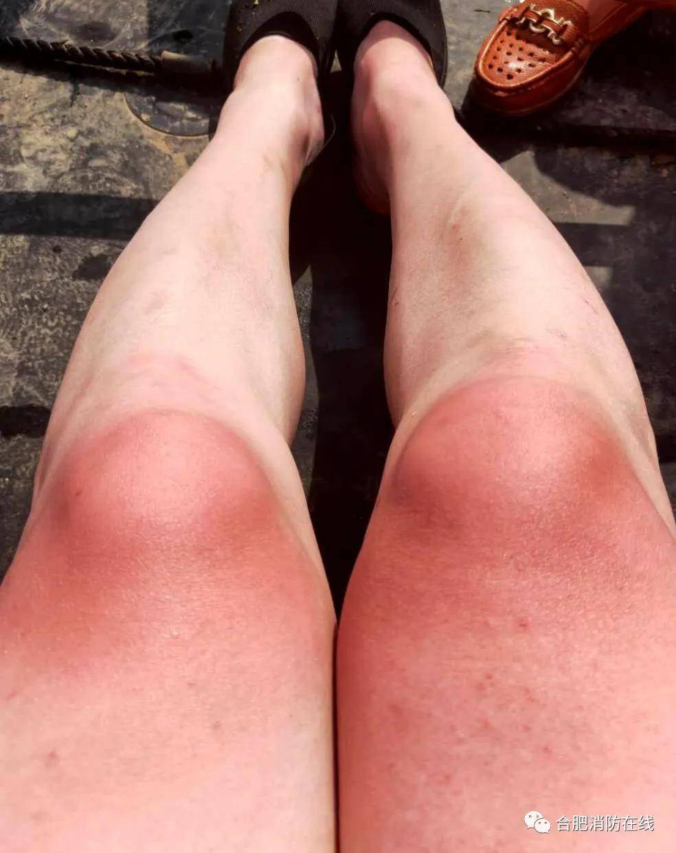 年仅36岁的他走了,唯一一条朋友圈让人泪崩