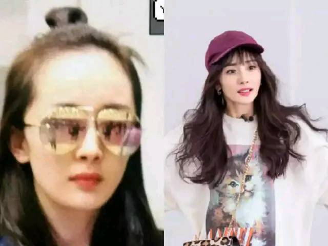女明星发际线后移,杨幂不算什么,更严重的是郑爽头发已明显减少