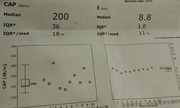 肝功gdp_肝功化验单