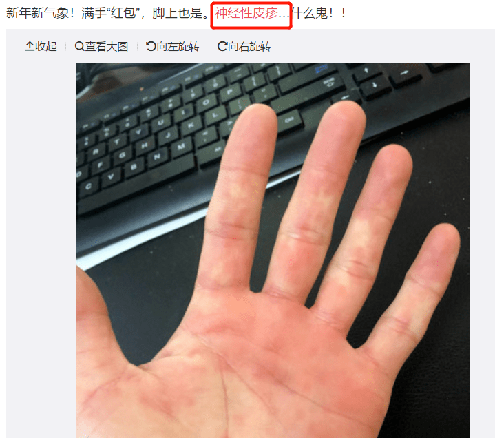 皮肤|从万人迷到万人嘲，最飒姐姐爆红遭反噬，这次卖惨连观众都不买账了？