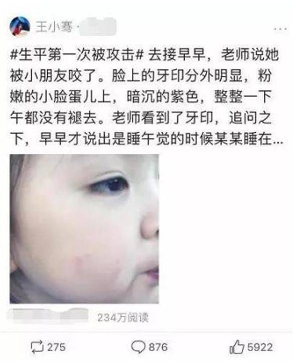著名主持人王小骞女儿，幼儿园被同学咬破脸，妈妈做法获网友高赞