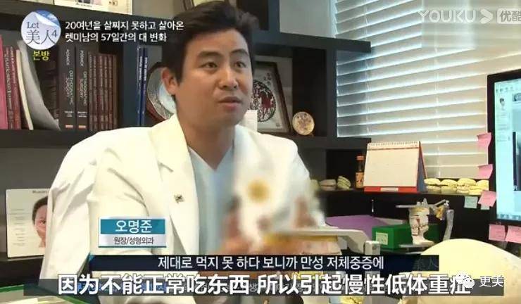 手术|回访|花3000万从“野兽”整成芭比的女孩，8年后过得怎么样