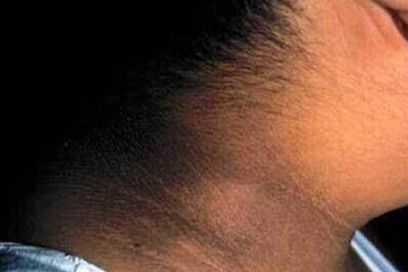 脖子|检查后，医生的话让宝妈自责又“好笑”7岁女儿脖子发黑洗不掉