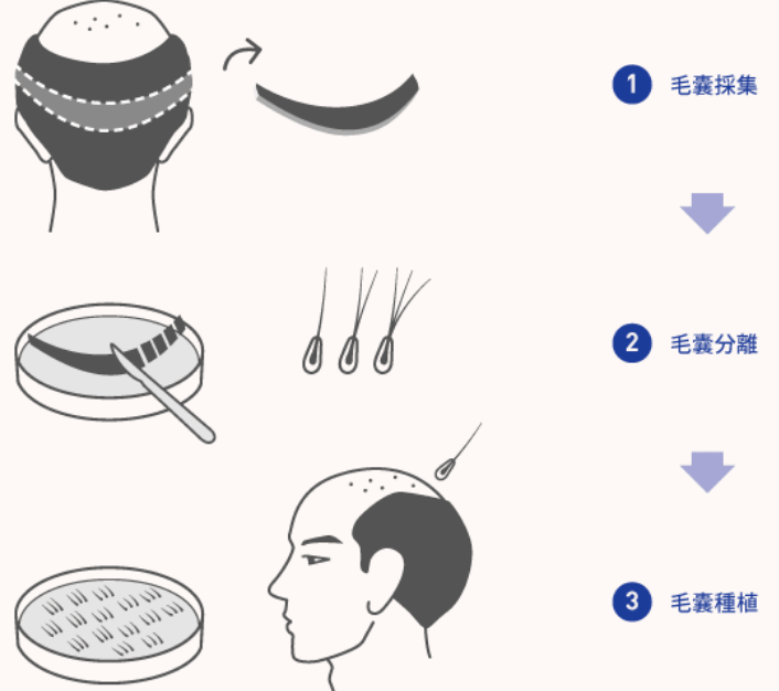 头发|娜扎消失的头发全回来了…这方法比鞠婧祎还高明！