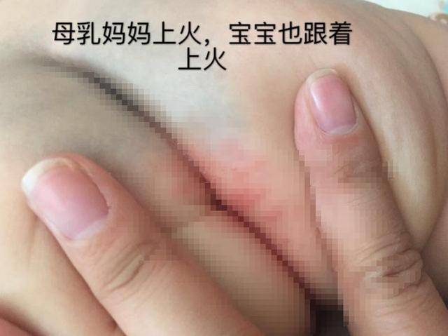 温水|应该选择温水清洗还是用纸巾擦？学问很多宝宝拉完“臭臭”之后