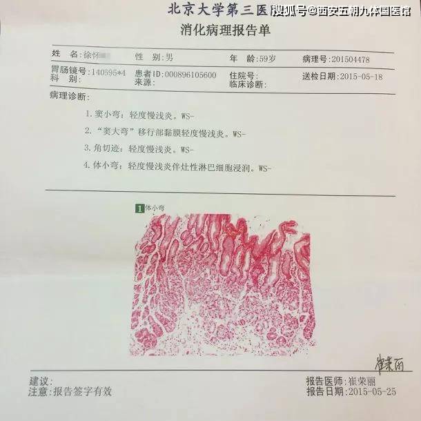 李学武膏方治疗萎缩性胃炎肠化成功逆转案例