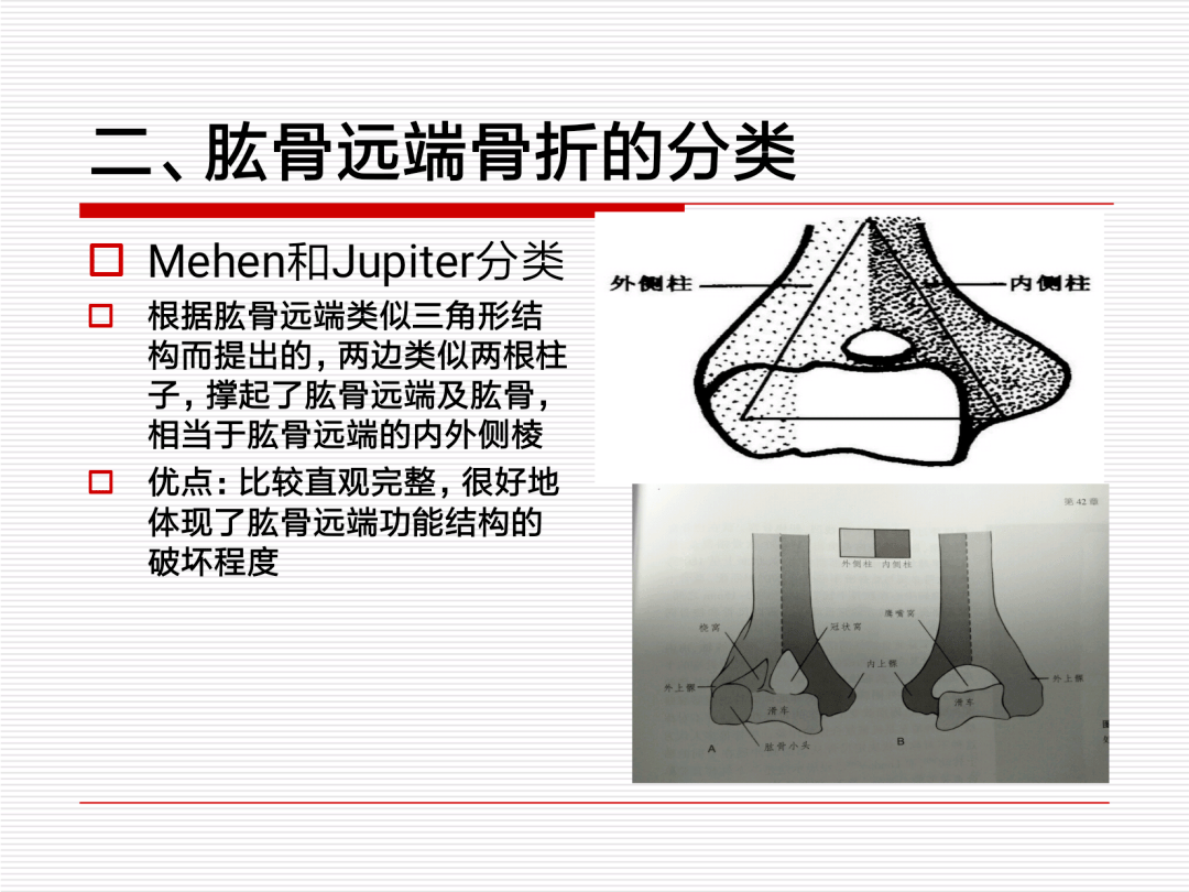 一文掌握肱骨远端骨折