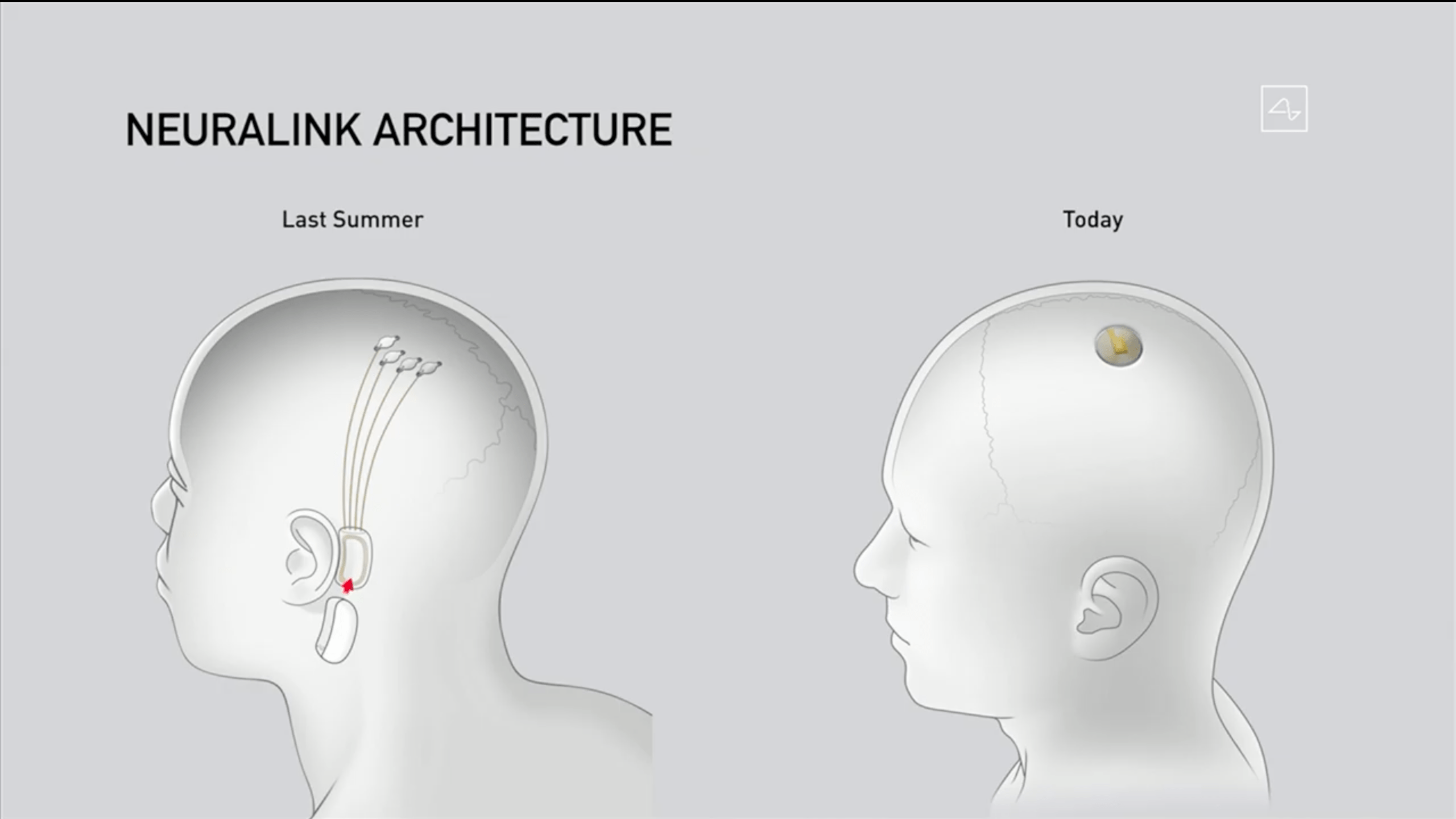 马斯克的脑机接口公司neuralink举行现场直播,展示了一头植入neural