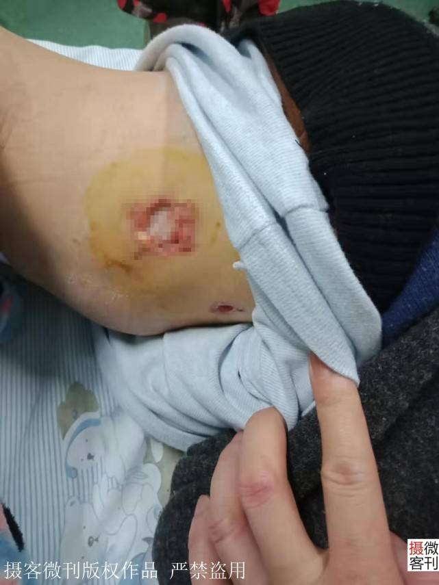残疾|儿子10岁后却发现悲剧了湖北残疾理发哥娶娇妻幸福满满