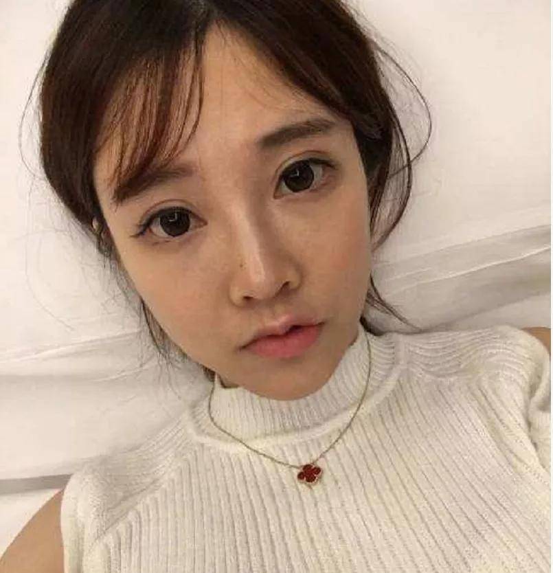 do|冯提莫这是后遗症出来了还是do了两次？搞成猪鼻子了…