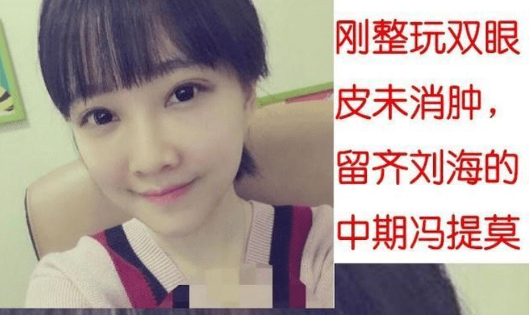 do|冯提莫这是后遗症出来了还是do了两次？搞成猪鼻子了…