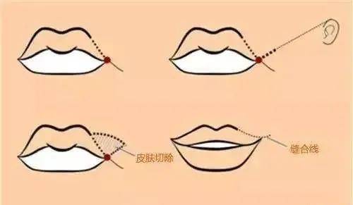 艾比|《青3》用变性女孩炒热度，还有下限吗？