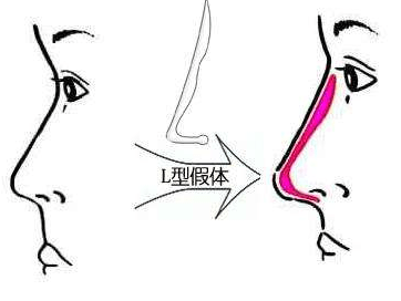 怎么快速解决鼻子堵的问题 4ab4d04fdf98407b9fd9c2a828d8ca37.png