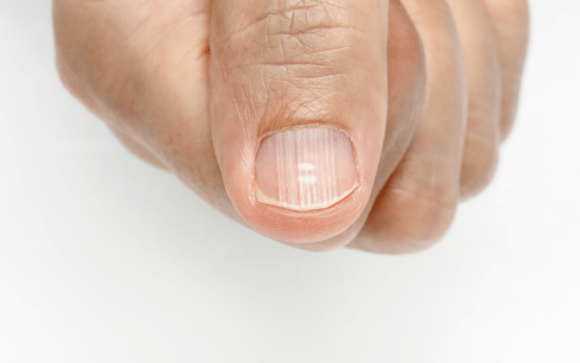 手脚|体内有癌,手脚先知,当手脚出现这些变化,说明肝已经病得不轻