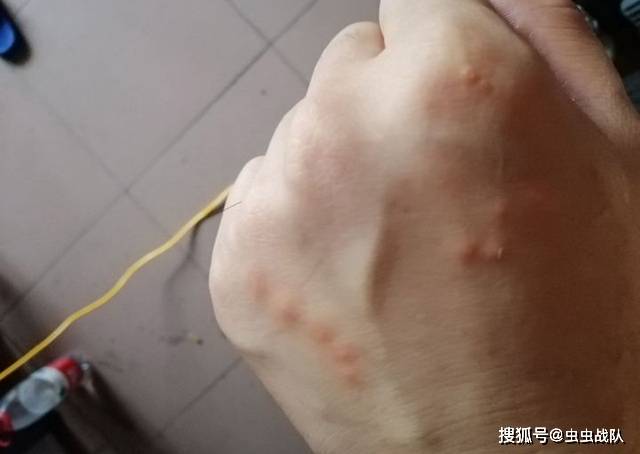 如何判断一个包是被跳蚤咬还是臭虫咬?