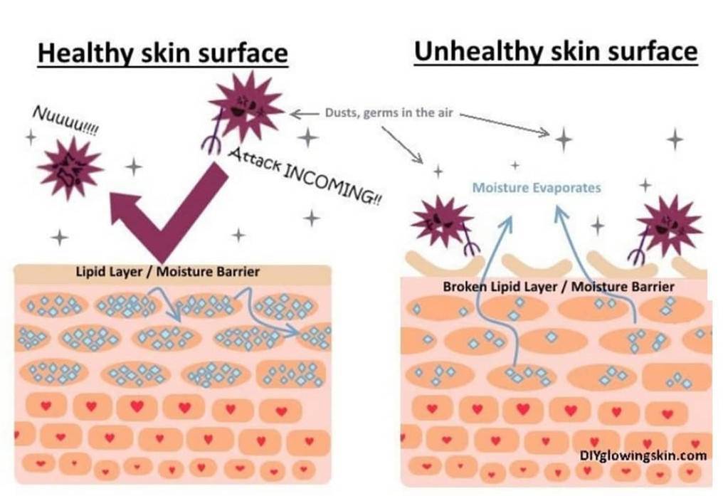 皮肤|口罩脸+换季!这下真的受不了了,敏感修复快看它