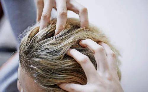 明星|女明星最想删掉的丑照，多数都是因为 ta