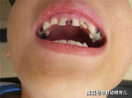 牛奶|奶奶经常给孩子喝这种牛奶,娃的身高落后别人一大截,还长了蛀牙