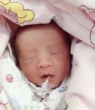 肠胀气|宝宝肠胀气一般都有哪些症状呢？该如何缓解宝宝肠胀气？
