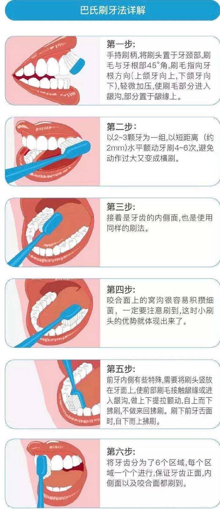 圆弧(fones)刷牙法