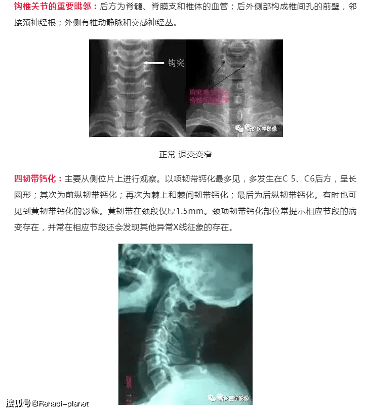 史上最详细的颈椎x线解剖解读经典收藏
