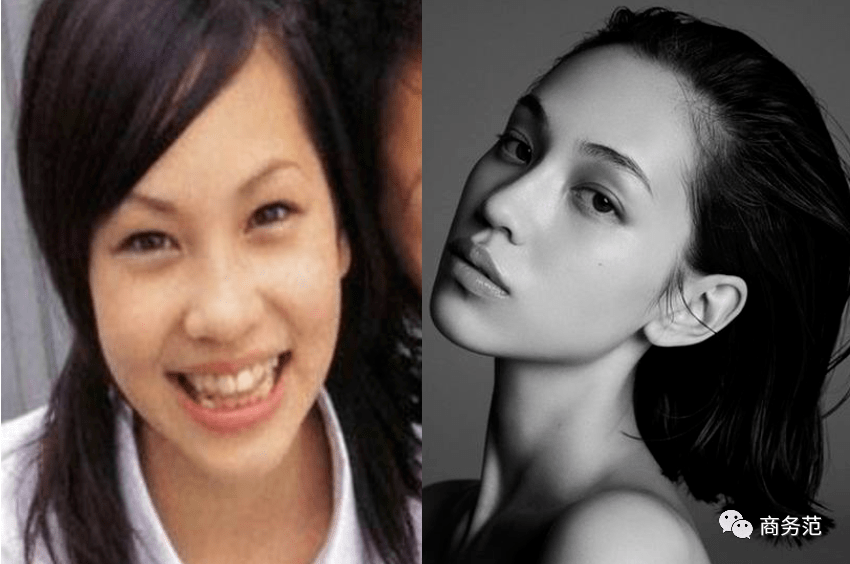 美容|一张脸要花几百万？贵妇美容账单太疯狂