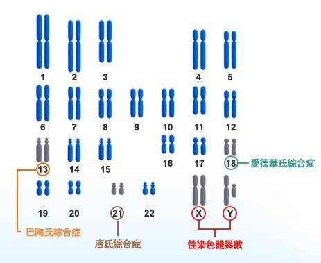 【唐筛敏儿安】染色体微缺失"小儿猫叫综合征"