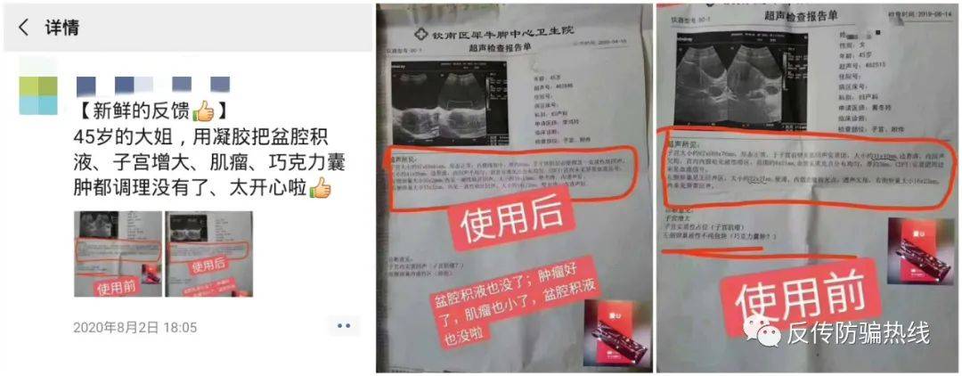 “零投资高回报”涉嫌传销 琦菲亚代理私护产品当药卖(图5)