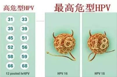 高危型hpv与低危型hpv有什么区别