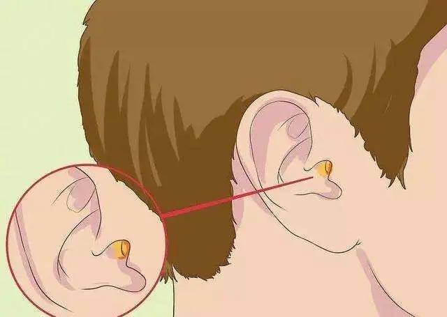6,当然,过度清理耳垢,最直接的效应便是对听力的影响.