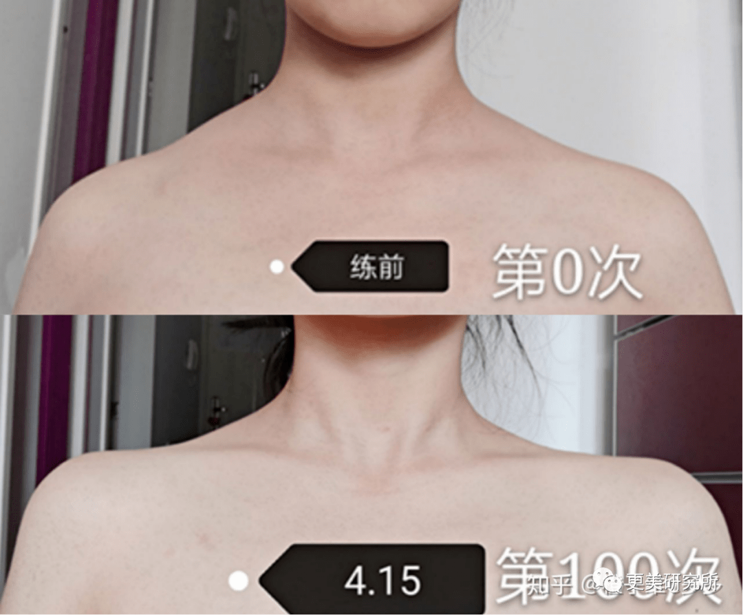 张子枫|曾被关晓彤秒成渣，如今“整容式”长大，削掉斜方肌后美翻