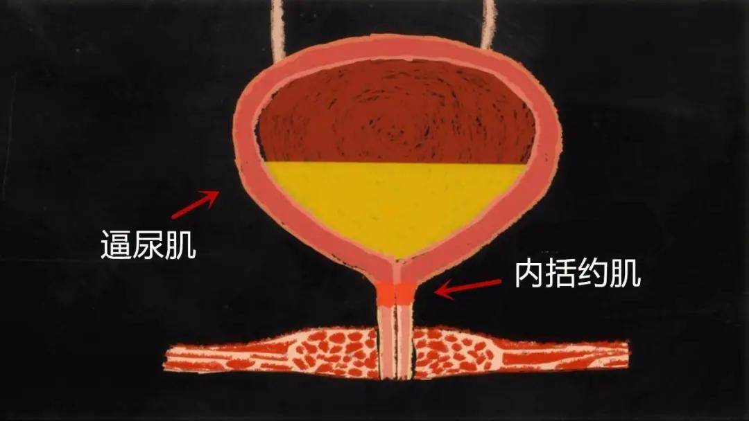 多系统萎缩与泌尿生殖系功能障碍_膀胱