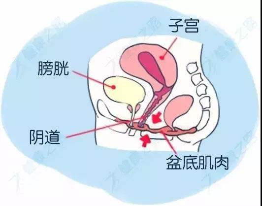 女性朋友盆底肌康复锻炼如何正确进行?