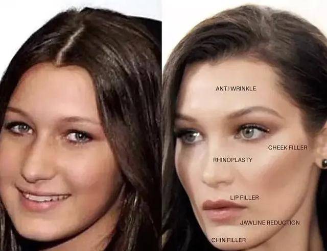 许玮|高圆圆动了这里年轻十岁，一直被当成天然脸的许玮甯做得最成功